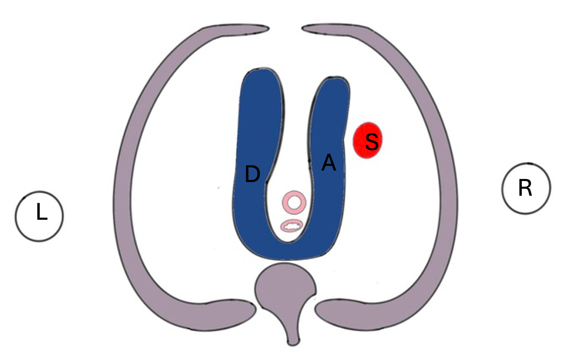 Exploring the V, U, and Y of the VT3 View – Fetal Cardiac Care
