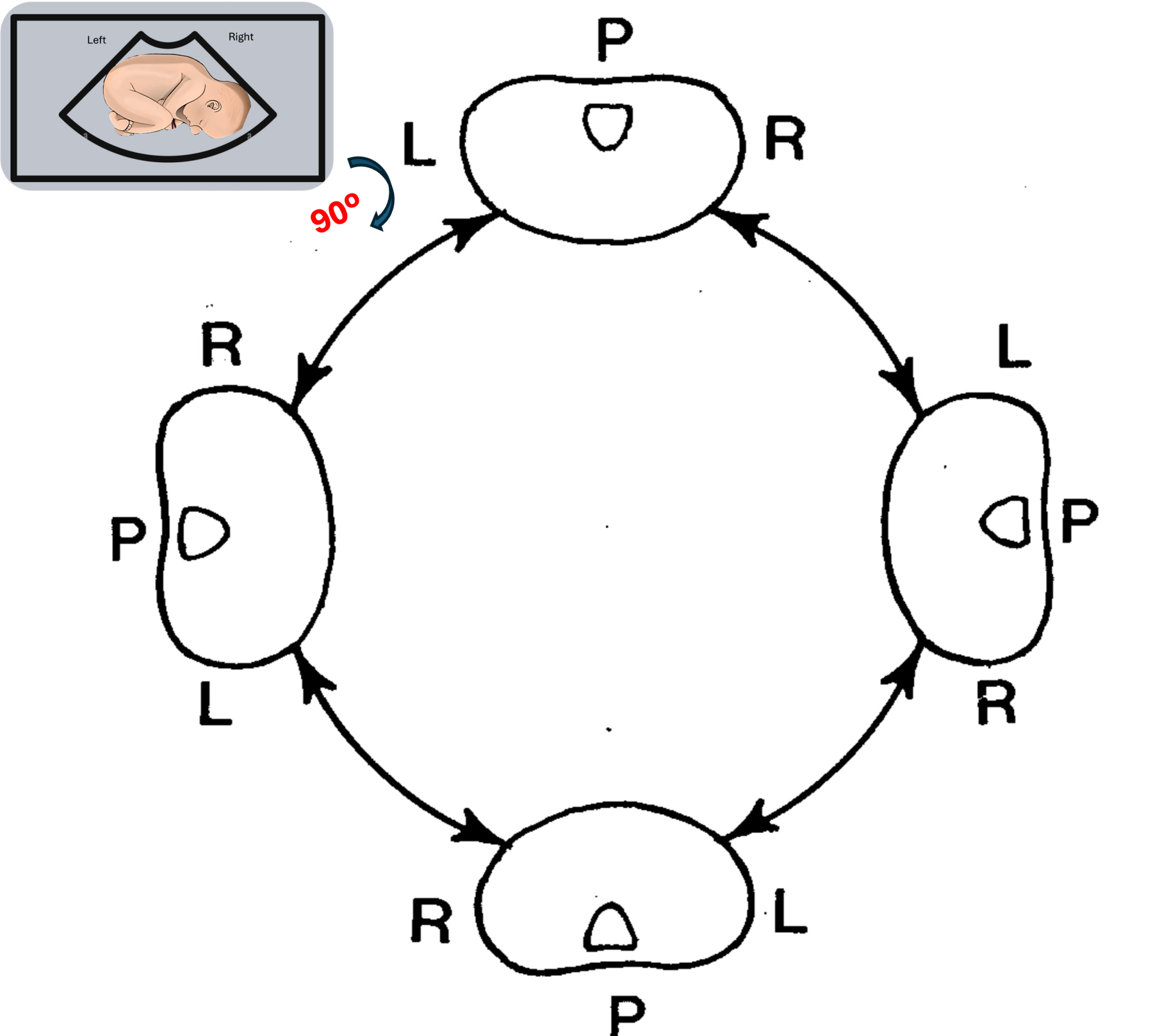 Fetal Situs Detection Simplified:A Practical Approach – Fetal Cardiac Care