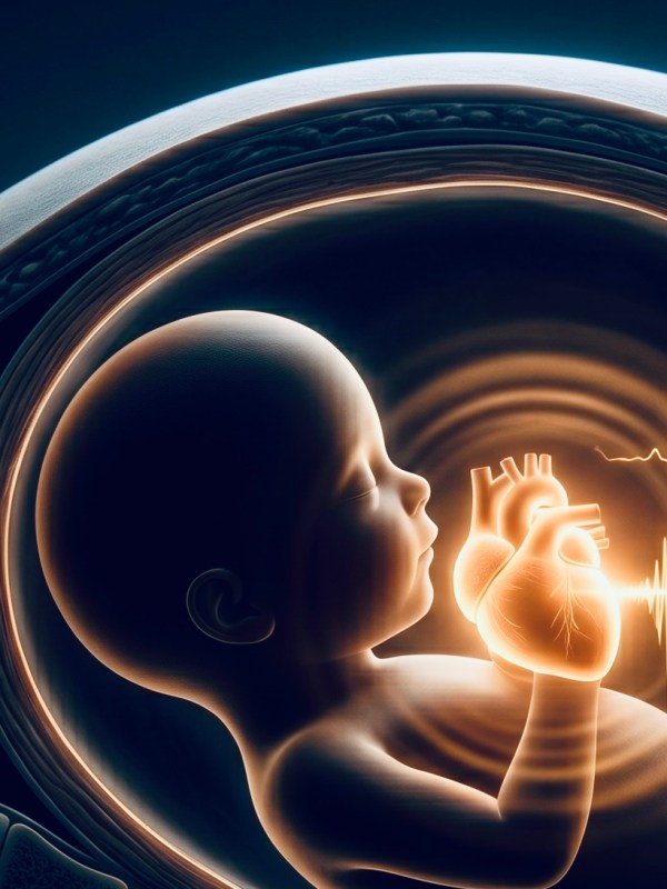 Measuring the Fetal PR Interval: Getting the Acquisition&nbsp;Right