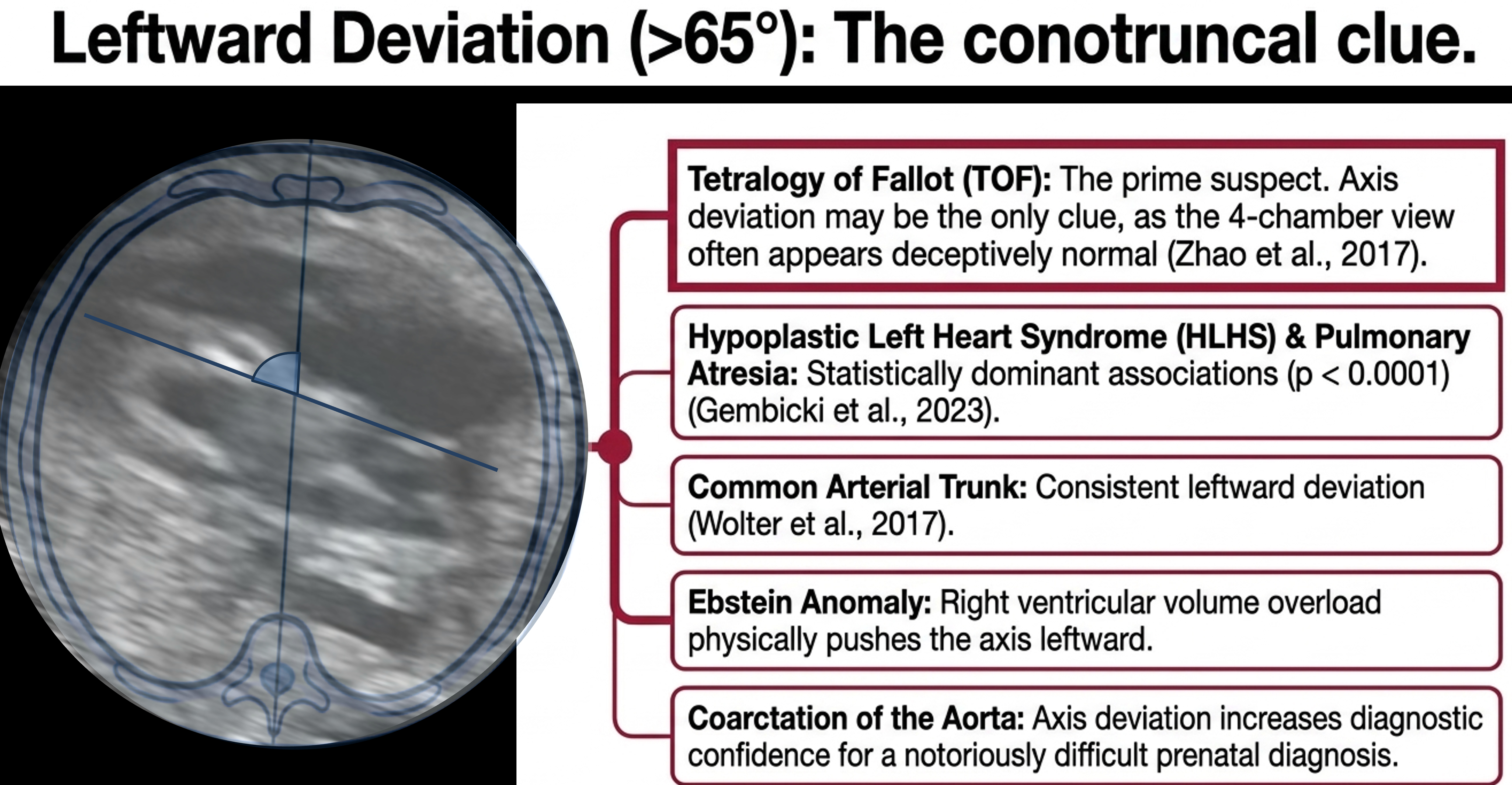 The Fetal Cardiac Axis: What’s Normal, What’s Not, and Why It Matters ...